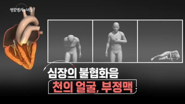 <Secret of Soldier Soldier> The Face of the Desonement of the heart, arrhythmia, arrhythmia